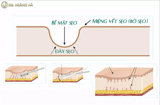 be-mat-seo