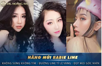 Nâng mũi Babie line giải pháp trẻ hóa an toàn
