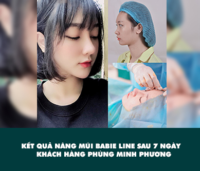 vid-nangmui