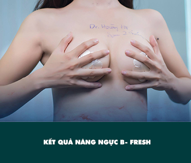 vid-nangnguc