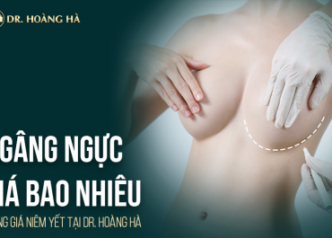 Nâng ngực giá bao nhiêu? Bảng giá niêm yết tại Dr Hoàng Hà