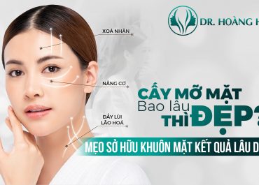 Cấy mỡ mặt bao lâu thì đẹp? 7+ Mốc thời gian hồi phục sau khi thực hiện