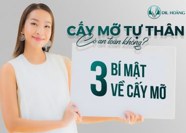 Cấy mỡ tự thân có an toàn không? 3 bí mật về cấy mỡ