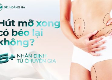 Hút mỡ xong có béo lại không - 5+ Nhận định từ chuyên gia 