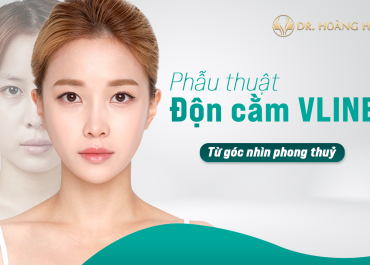 Phẫu thuật độn cằm V-Line từ góc nhìn phong thủy