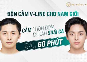 Độn cằm V-Line cho nam giới - Cằm thon gọn chuẩn soái ca sau 60 phút