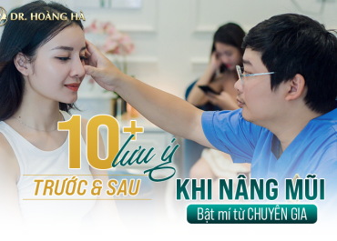 10+ lưu ý TRƯỚC & SAU khi nâng mũi - Bật mí từ chuyên gia