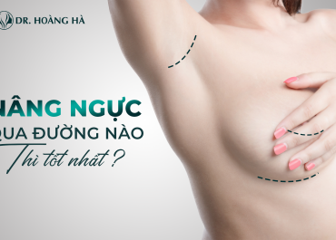 Nâng ngực qua đường nào tốt nhất trong phẫu thuật nội soi?