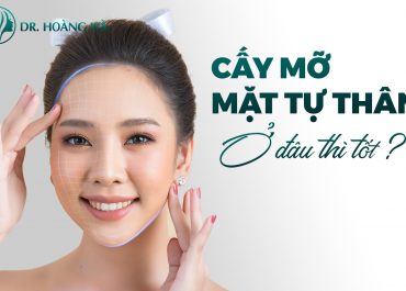 Cấy mỡ mặt ở đâu tốt nhất - An toàn - Hiệu quả tại Hà Nội