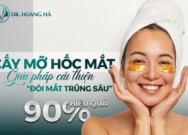 Cấy mỡ hốc mắt - Giải pháp cải thiện “Đôi mắt trũng sâu” hiệu quả 90%