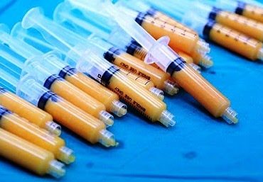 Cấy mỡ ngực có ảnh hưởng đến tuyến sữa không? Bác sĩ giải đáp