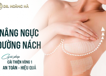 Nâng ngực đường nách - Giải pháp cải thiện vòng 1 an toàn hiệu quả