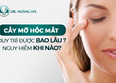 Cấy mỡ hốc mắt sâu duy trì được bao lâu - Chia sẻ từ chuyên gia