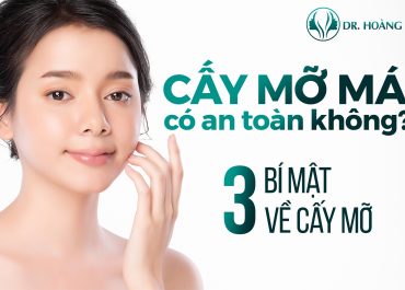 Cấy mỡ má có an toàn không - 3 bí mật về cấy mỡ