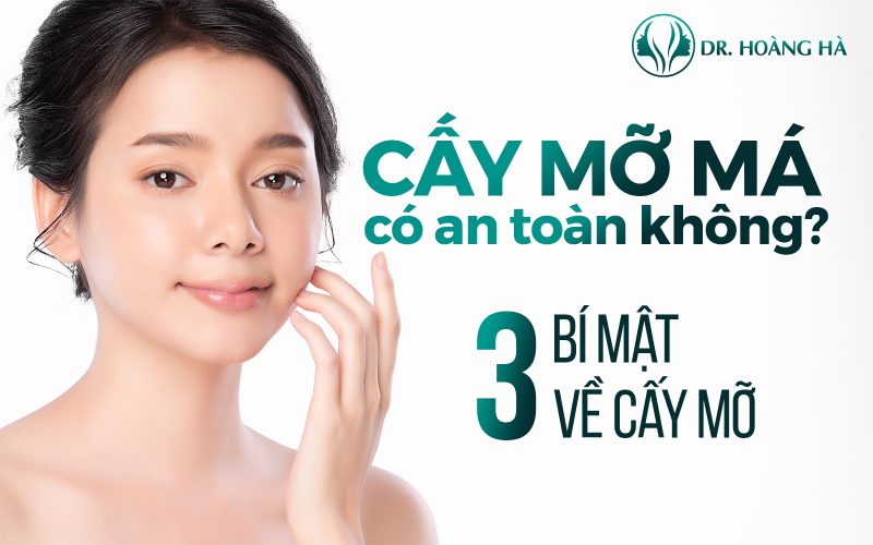 Cấy mỡ má có an toàn không - 3 bí mật về cấy mỡ