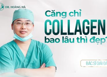 Căng chỉ collagen bao lâu thì đẹp? Bác sĩ Nguyễn Hoàng Hà giải đáp