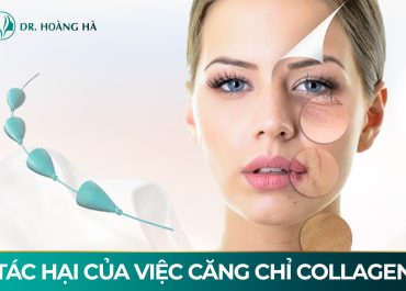 Căng Chỉ Collagen có hại không? Chia sẻ từ chuyên gia