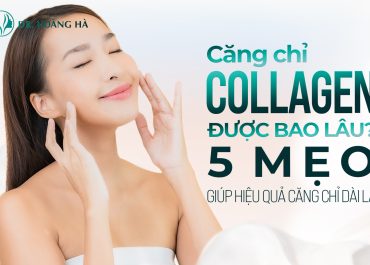 Căng chỉ collagen được bao lâu? Mẹo chăm sóc hậu phẫu