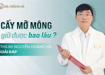 Cấy mỡ mông giữ được bao lâu? Ths.BS Nguyễn Hoàng Hà giải đáp