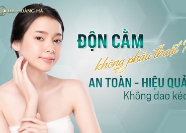 Độn cằm không phẫu thuật? AN TOÀN - HIỆU QUẢ không dao kéo