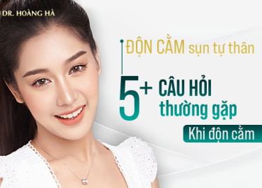 Độn cằm sụn tự thân? 5+ câu hỏi thường gặp khi độn cằm