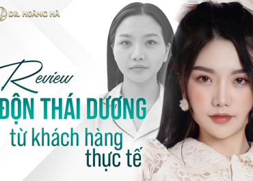 Review độn thái dương từ những khách hàng thực tế (Yan.vn, Toplist)