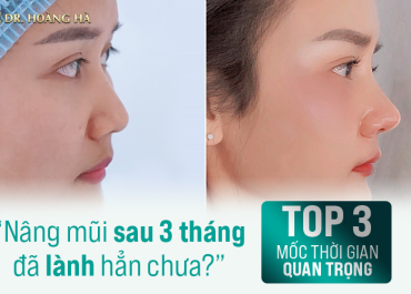 Nâng mũi sau 3 tháng đã lành hẳn chưa? - Top 3 mốc thời gian quan trọng