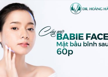 Cấy mỡ má baby - Giải pháp trẻ hóa má hóp an toàn không phẫu thuật