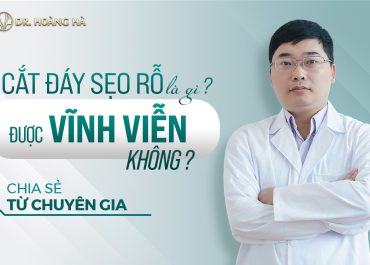 Cắt đáy sẹo rỗ là gì? được vĩnh viễn không?- Chia sẻ từ chuyên gia