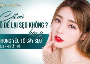 Cắt mí có để lại sẹo không? 3+ Yếu tố gây sẹo sau cắt mí