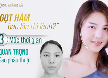 Gọt hàm bao lâu thì lành? 3 Mốc thời gian quan trọng sau phẫu thuật