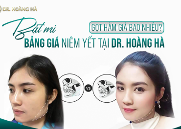 Gọt hàm giá bao nhiêu? Bật mí bảng giá niêm yết tại TMV Dr Hoàng Hà