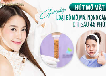 Hút mỡ mặt - Giải pháp Loại bỏ mỡ má, nọng cằm chỉ sau 45 phút