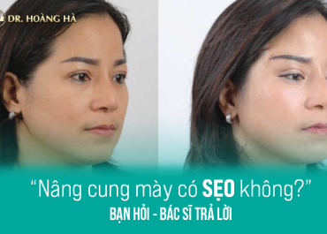 Nâng cung mày có sẹo không? Bạn hỏi - Bác sĩ trả lời