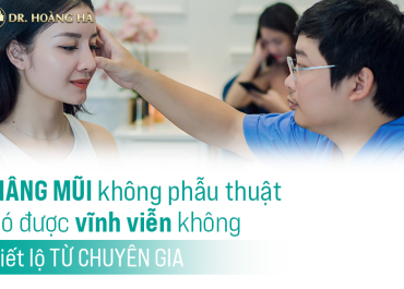 Nâng mũi không phẫu thuật có được vĩnh viễn không? Tiết lộ từ chuyên gia