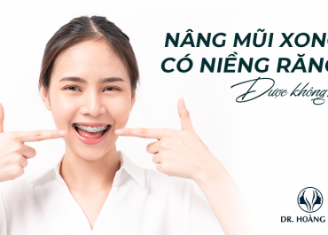 Nâng mũi rồi có niềng răng được không? Bạn hỏi - Bác sĩ trả lời