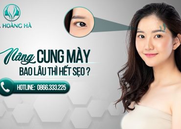 Nâng cung mày bao lâu thì hết sẹo? Chia sẻ từ Bs. Hoàng Hà