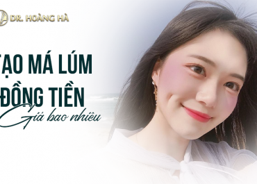 Tạo má lúm đồng tiền giá bao nhiêu? Giá ưu đãi tại Dr Hoàng Hà