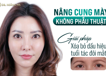 Nâng cung mày không phẫu thuật - Giải pháp xóa bỏ dấu hiệu tuổi tác đôi mắt