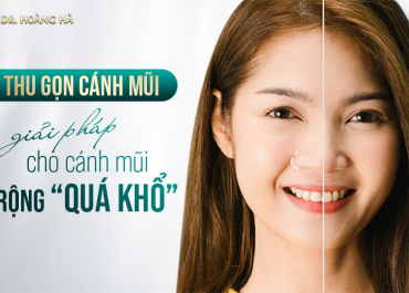 Thu gọn cánh mũi - Giải pháp cho cánh mũi rộng “quá khổ”