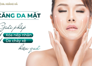 Căng da mặt - Giải pháp xóa nếp nhăn, da chảy xệ hiệu quả