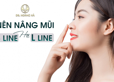 Nâng mũi S line và L line khác nhau như nào? Chuyên gia “ Giải đáp”