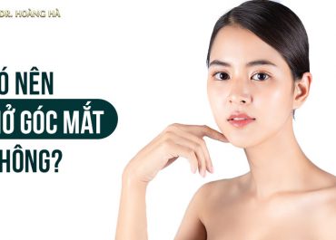 Có nên mở góc mắt không? Bác sĩ Hoàng Hà “Giải Đáp”