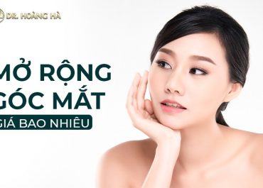 Mở góc mắt giá bao nhiêu tiền? Cập nhật bảng giá mới nhất 2021