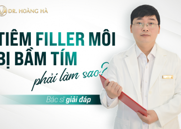 Tiêm filler môi bị bầm tím phải làm sao? Bác sĩ “Giải đáp”