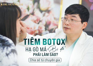 Tiêm botox hạ gò má bị đơ phải làm sao? Chuyên gia giải đáp