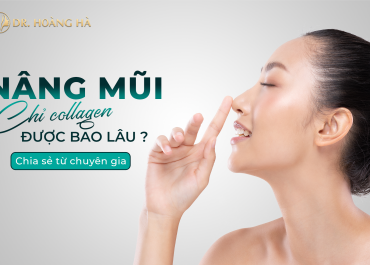 Nâng mũi chỉ collagen được bao lâu? Chuyên gia giải đáp