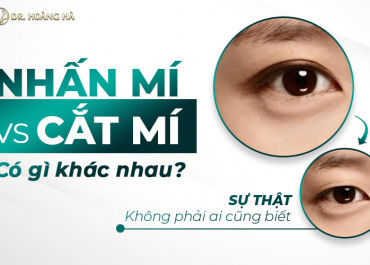 Nhấn mí và cắt mí có gì khác nhau? SỰ THẬT không phải ai cũng biết