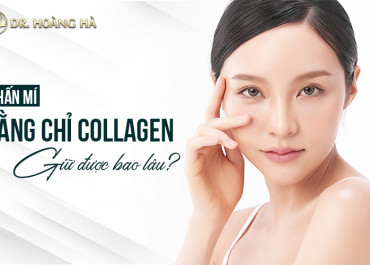 Nhấn mí mắt bằng chỉ collagen giữ được bao lâu? Chuyên gia giải đáp