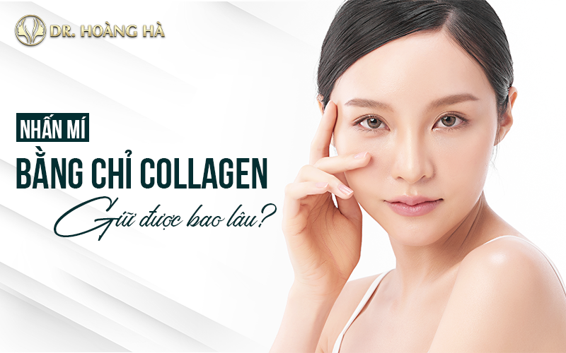 Nhấn mí mắt bằng chỉ collagen giữ được bao lâu? Chuyên gia giải đáp